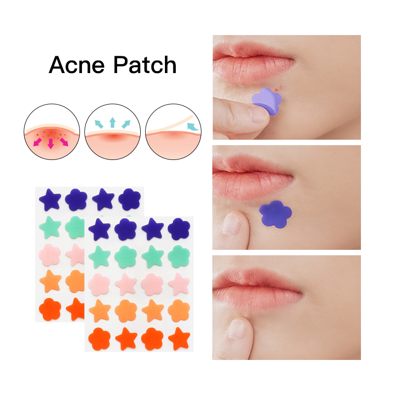 Acne Patch