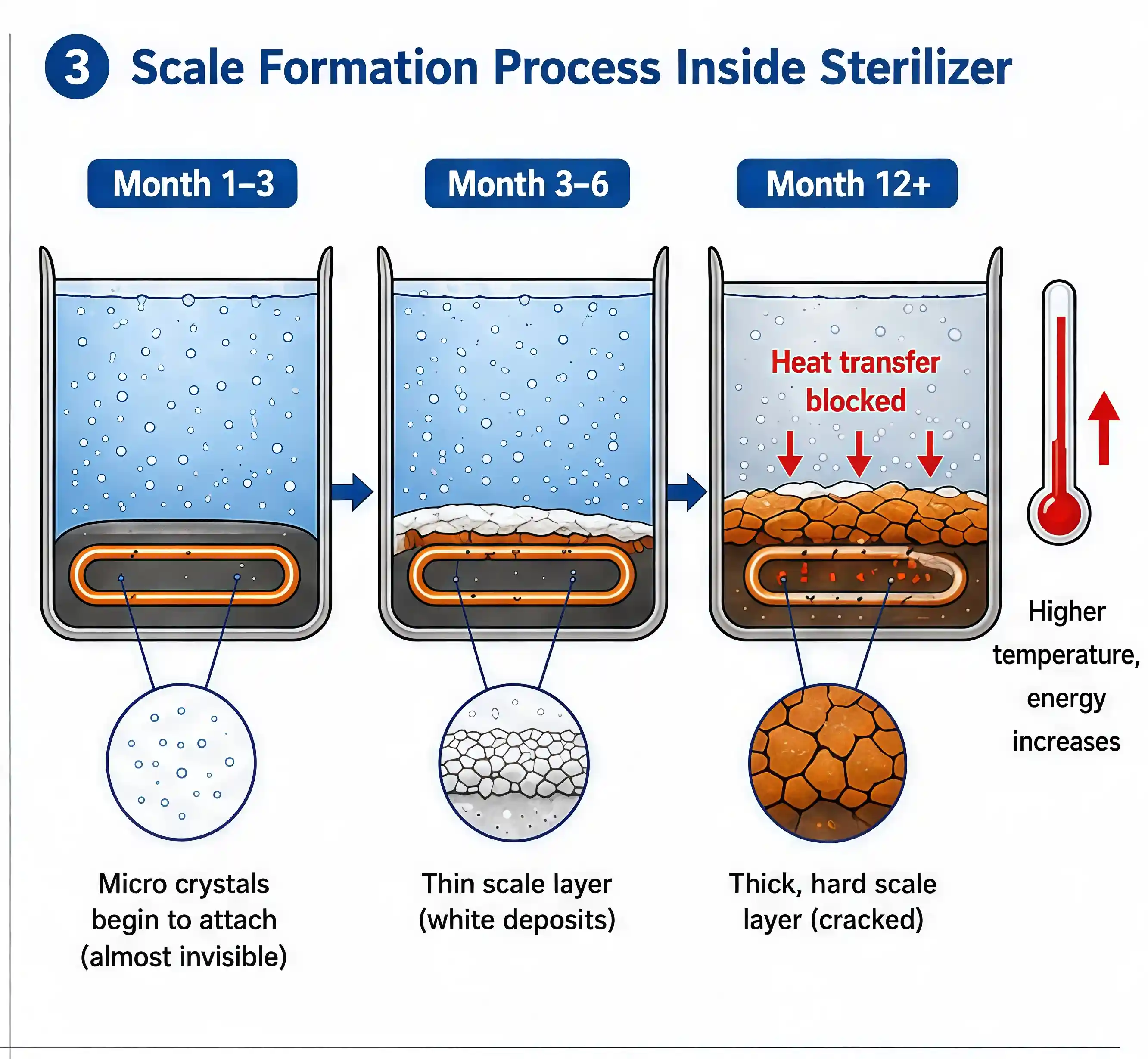 Scale Formation Process Inside Sterilizer